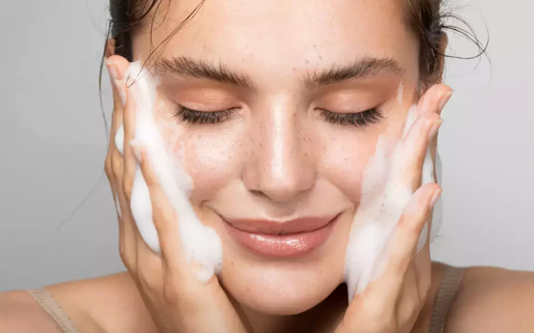 TLC for Pores And Skin With Acne