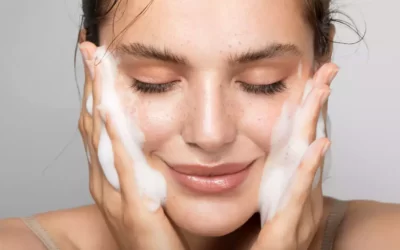 TLC for Pores And Skin With Acne