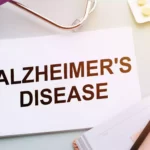 How is Alzheimers Diagnosed 1